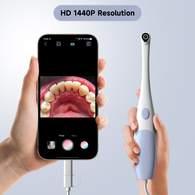 Kamera Endoskop Oral 1440P Fot - Macro Photography Led Lighting ulasan dan harga